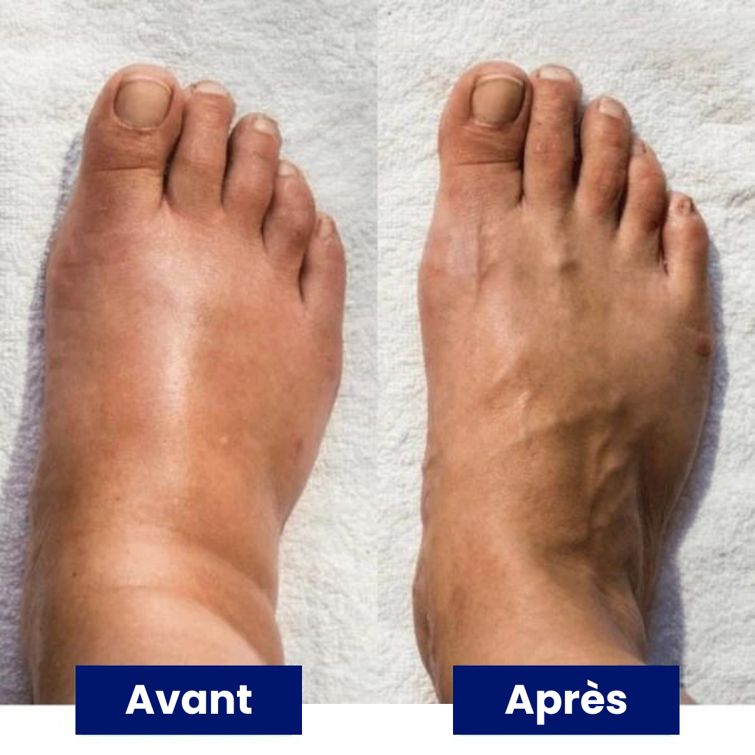 Novari | Masseur de Pieds EMS