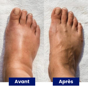 Novari | Masseur de Pieds EMS